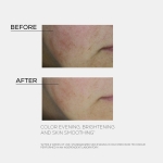 INFUSÍON LIFT Liftinghatású Krém Perfect Glow Hatással SPF 30