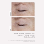 INFUSÍON LIFT Intensywnie Liftingujące Serum Ujędrniające