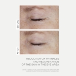 INFUSÍON LIFT Supreme - Lift Firming Serum